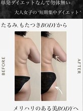 【よもぎ蒸し温活痩身×水素吸入】YOSAPARK ALUA FEM/水素吸入！短期集中ダイエット！