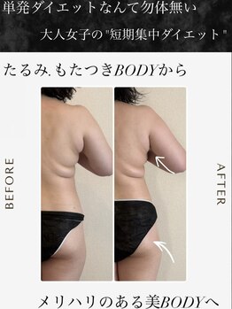 【よもぎ蒸し温活痩身×水素吸入】YOSAPARK ALUA FEM/水素吸入！短期集中ダイエット！
