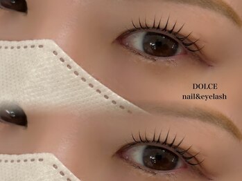ドルチェ 久留米花畑店(Dolce)/Dolceリフト