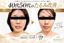 リコメンス(Recommence)
