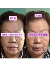 エステティックサロン S/81歳でも変われる！