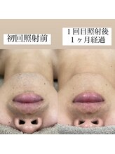 テンパ ビューティー(+10%beauty)/効果写真