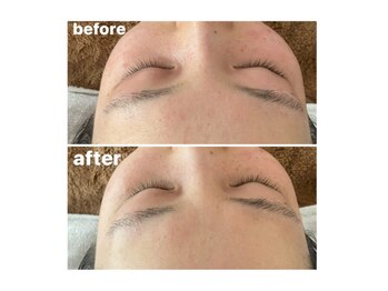 メナードフェイシャルサロン 岐阜茜部/パックホワイト