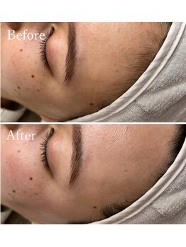 ホワイトワックス 京都四条烏丸(WHITE WAX)/生え際もスッキリ◎