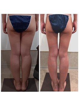 アイディエム 新宿店(IDM)/【モニター】161ｃｍ・30代