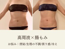 ミオン(美温)/便秘/冷え/生理のお悩みの方に！