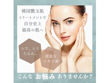 シャイニー(Shiny)