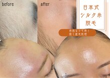 ナチュウル(Natulu)