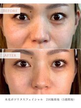 サロンド エステ ミニョン(salon de esthe mignon)/韓国水光肌ボニックスダーマ♪