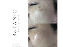 ボタニック 福津店(BoTANiC)の雰囲気（【Before→After】写真を随時UP中!! 驚くほどツルツルに）