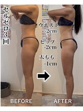 ベルフルール 浜松中野町店/20代女性セルゼロ全身3回