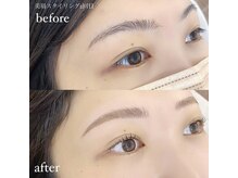 ベージュロータス(beige lotus)/WAXで眉周りのお肌トーンアップ