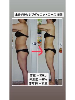 ボディグロス 梅田店(BODY GLOSS)/ブライダルエステ