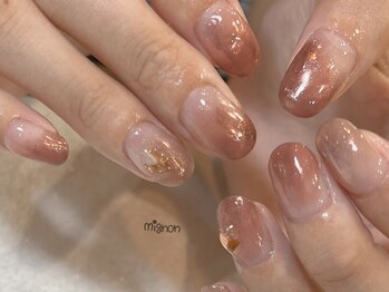 ミニョン(mignon)/Mignon定額コース