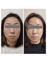 まほろば鍼灸整骨院 美骨痩身ベルナ(BELUNA)/お顔のエステもやってます♪