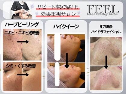 フィール(FEEL)の写真