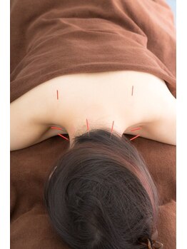 ココビ 津高店(COCO美)/鍼×体