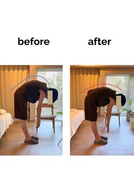 フィデル(fidele)/スマホ由来の頚肩凝り症例