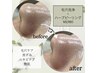 【9月限定】毛穴レス肌◎毛穴洗浄×ハーブピーリング ¥11000→￥8980