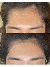 ラダ(RADA)/フェイスワックス/アノン