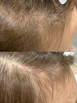 ヒルナム(Heal Nam)/プロセルセラピーズ~頭皮~