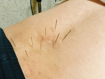 エイトはり きゅう院の写真/【その腰の痛みは放置しないで！】この時期に増える腰の痛みやツラサ、院長の手技でしっかり改善◎