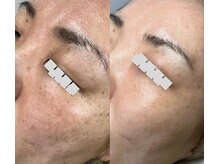 ミレット(Miretto)/