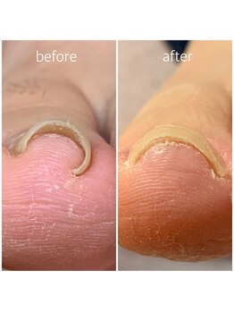 リネイル 長浜(Re-na-iL)/ネイルケア＆スパ¥7000