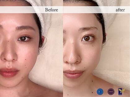 ホワイトカメリア(White Camellia)の写真