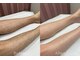 モアラニ(Moalani)の写真/スポーツ選手も通う老舗サロン◎痛みの少ないワックス＋光脱毛のダブル脱毛で自己処理不要のスベスベ肌に