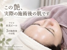 ベルネ(BELLUNE)