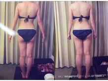 パーフェクトボディプレミアム 札幌大通店(PERFECT BODY PREMIUM)/お客様　ビフォーアフター（6）