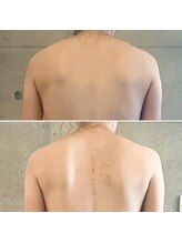 サプナジー(Suppnrgy)/カスタムトリートメント