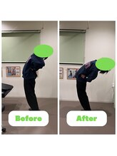 ナオル整体 長崎大村院(NAORU整体)/20代男性施術事例【猫背矯正】