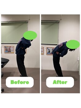 ナオル整体 長崎大村院(NAORU整体)/20代男性施術事例【猫背矯正】