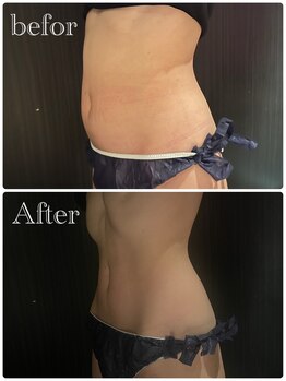 テテ(TeTe)/ぽっこりお腹にはこれ!!