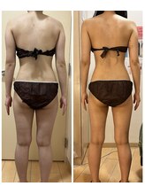 レイビス 仙台店(RAYVIS)/口コミ評価◎RAYVISの痩身コース