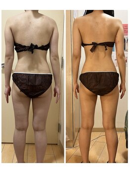 レイビス 仙台店(RAYVIS)/口コミ評価◎RAYVISの痩身コース