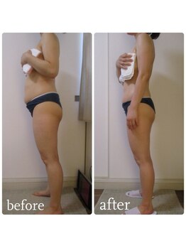 加圧ビューティーサロン スタイル エム(beauty salon style M)/30代/加圧×パワーツリー120分