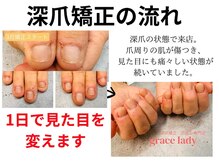 グレースレディ 神戸北店/