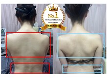 ゴールドハンド 溝の口店(Gold Hand)/＃ブライダル肩甲骨鎖骨痩身