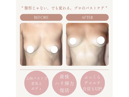 ビウラ(BIURA)の写真