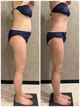 トータルビューティー ミミ(Total Beauty mimi)/