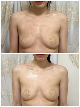 エルミナ.(elmina.)/少ない回数でもハリ感UP☆