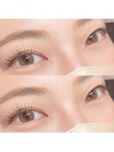 フーフロー(Fooflow)/フラットラッシュ100本