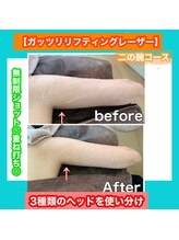 ビューティ ウィッチ(Beauty Witch)/