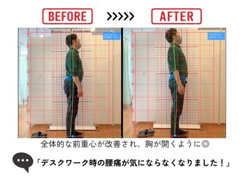 ゼロスポ鍼灸院 接骨院 上中居/ビフォーアフター(男性)