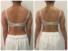 カナエルサロン 旭川(KANAERU SALON)/【バスト残しダイエット】症例☆