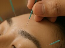 ミヅキビューティー(MIDUKI BEAUTY)の雰囲気（初めての美容鍼もお任せください◎小顔/リフトアップ/たるみ予防）