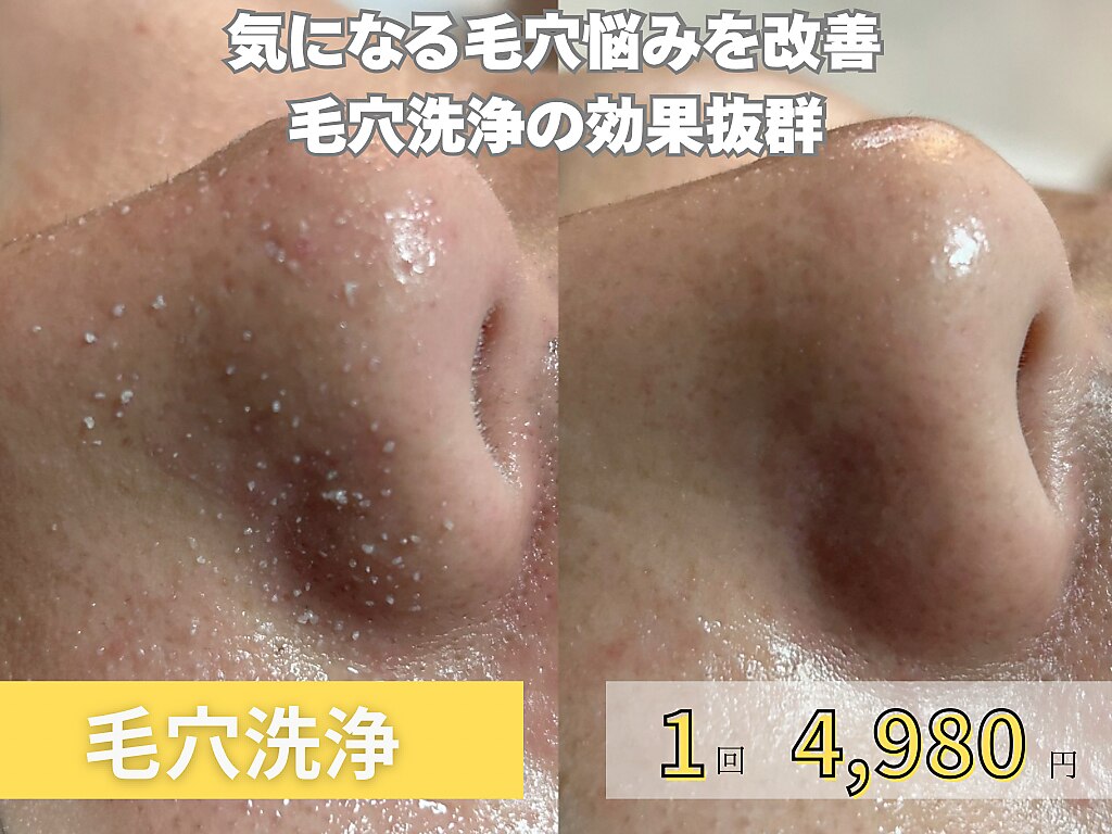 ドルチェ(Dolce)｜ホットペッパービューティー